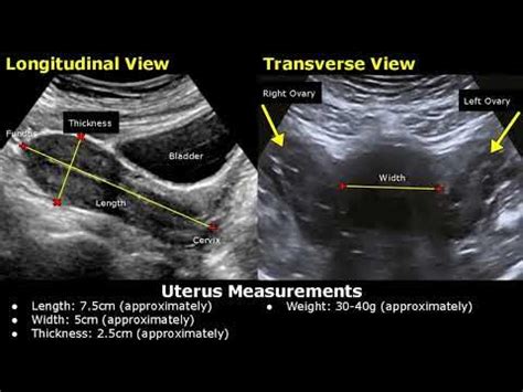 ultrasound early signs uterus measurements thickness before egg implantation|early pregnancy ultrasound timing.